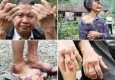 بیماری عجیب و ناشناخته در روستایی در کشور چین + تصاویر